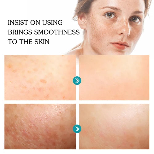 Jaysuing Niacinamide Skin Lightening Spots Shrinking Pores Hydrating  Anti-wrinkle And Skincare Serum