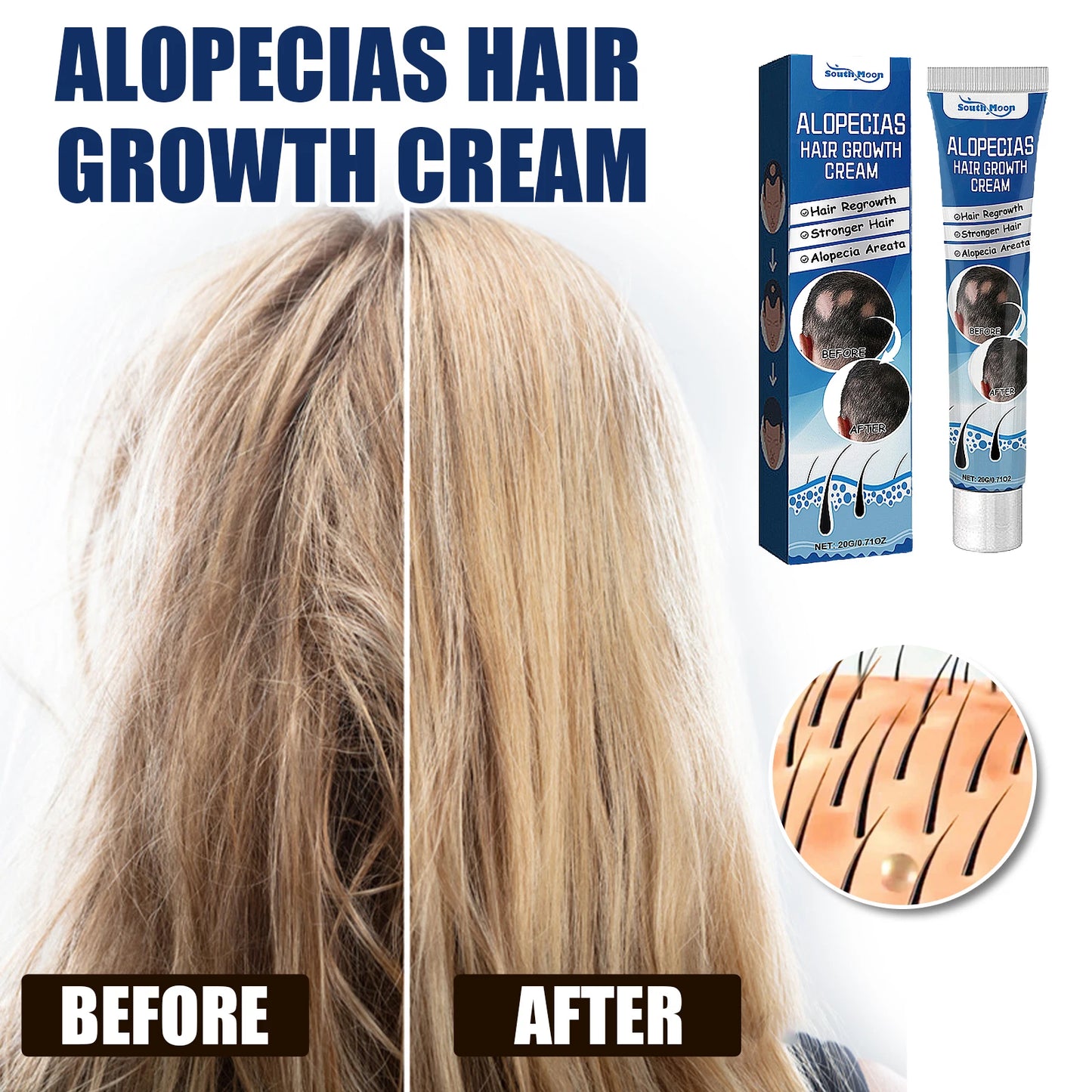 South Moon Sophora flavescens baldness cream head skin care cream cross-border foreign trade hair care Protecting