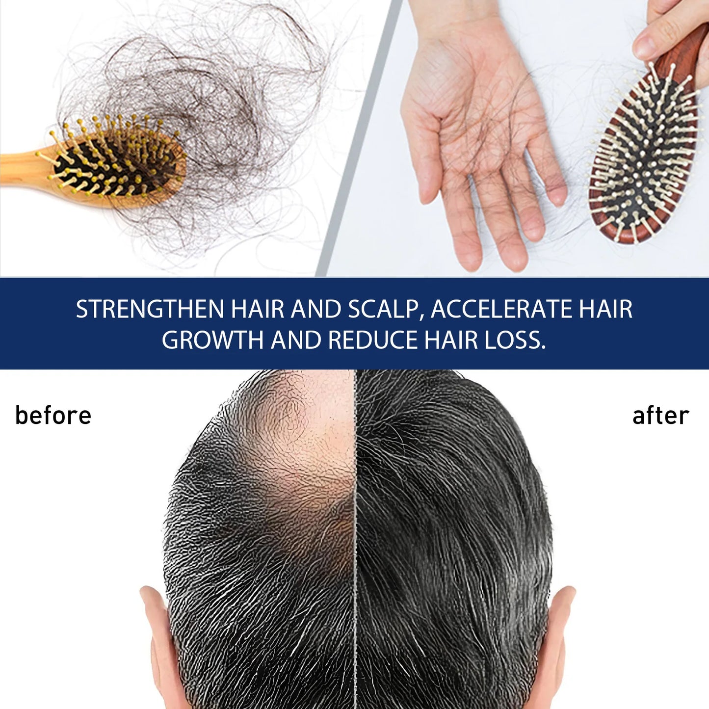 South Moon Sophora flavescens baldness cream head skin care cream cross-border foreign trade hair care Protecting