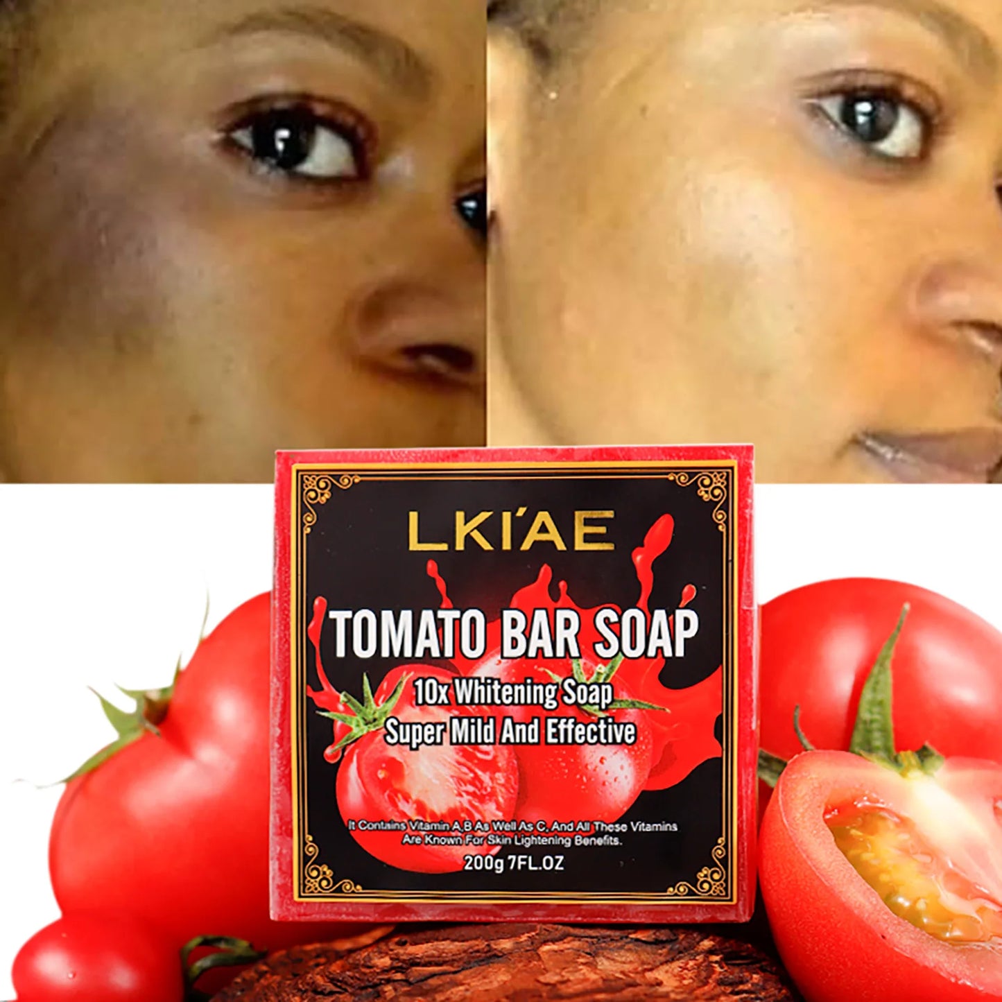 LKIAE Whitening Reduce Dark Spots & Hyperpigmentation Facial Brightening Vitamin C Bar Soap For The Skin Care