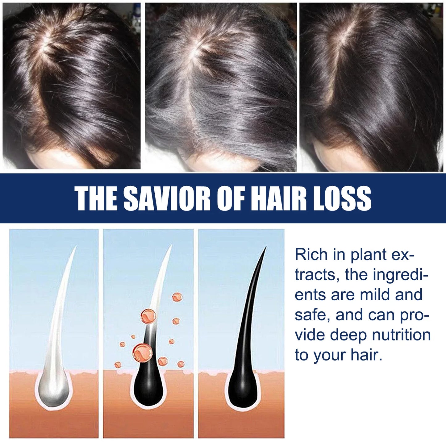 South Moon Sophora flavescens baldness cream head skin care cream cross-border foreign trade hair care Protecting