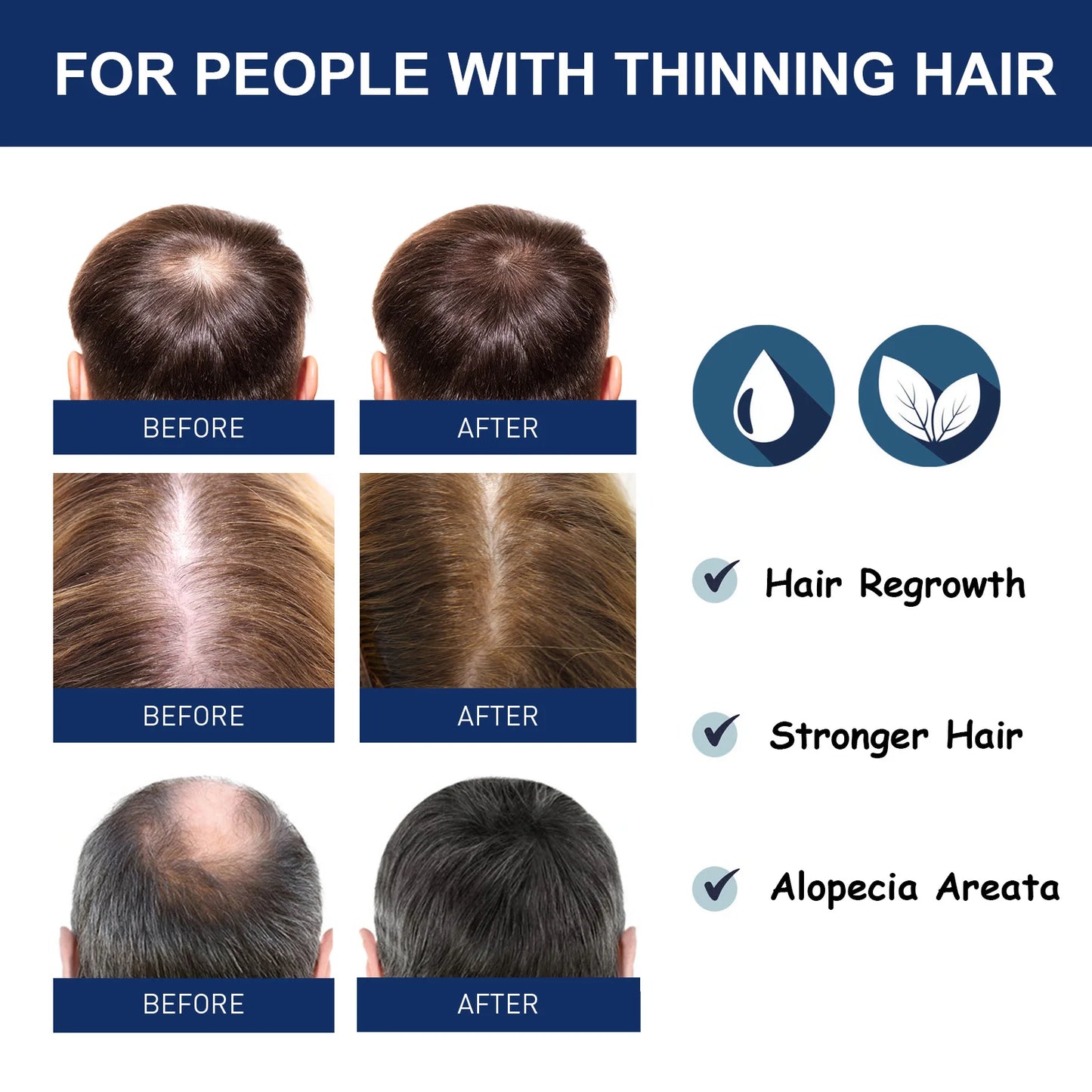 South Moon Sophora flavescens baldness cream head skin care cream cross-border foreign trade hair care Protecting