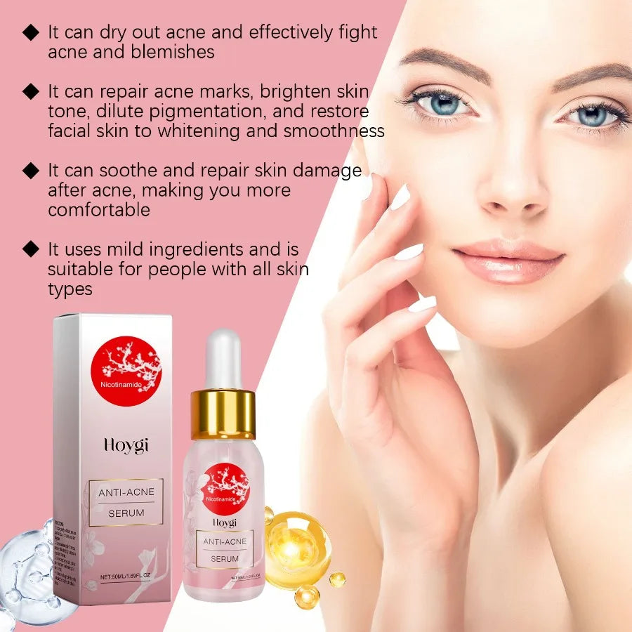 Hoygi Nicotinamide AntiAcne Serum Mild AntiAcne Serum Improve Acne Moisturizing Repair Serum