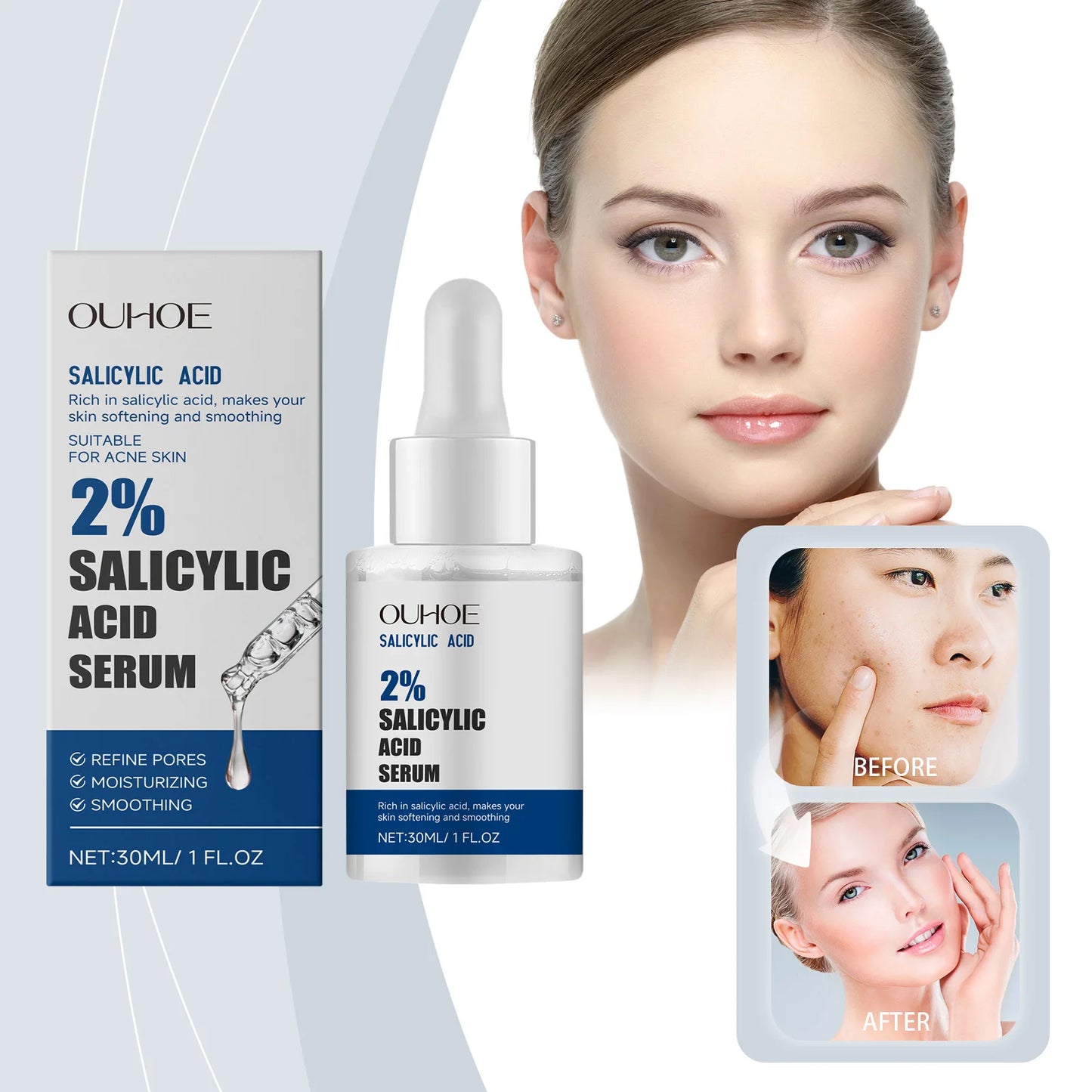 Acne Treatment Serum - Gentle, Nourishing, Pore Minimizing & Blemish Control Face Essence for Oily Skin, Anti-Acne Skin Care